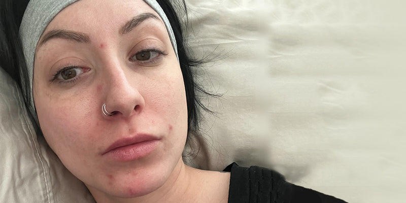 Marissa Madrid before using Earth & Halo Blue Crystalline Face Serum